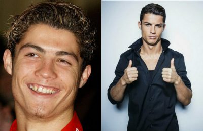 young ronaldo transformation
